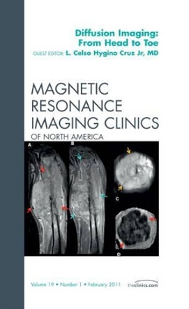 Clinical Applications of Diffusion Imaging: from Head to Toe, An Issue of Magnetic Resonance Imaging Clinics by Celso Hygino 9781455704668