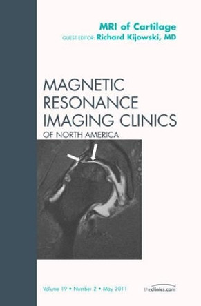 MRI of Cartilage, An Issue of Magnetic Resonance Imaging Clinics by Richard Kijowski 9781455707423