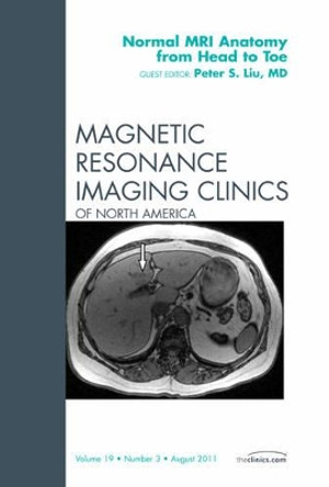 Normal MR Anatomy from Head to Toe, An Issue of Magnetic Resonance Imaging Clinics by Peter S. Liu 9781455710355