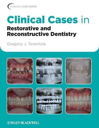 Clinical Cases in Restorative and Reconstructive Dentistry by Gregory J. Tarantola 9780813815640