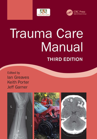 Trauma Care Manual Ian Greaves (University of Teeside. British Army) 9781032054353