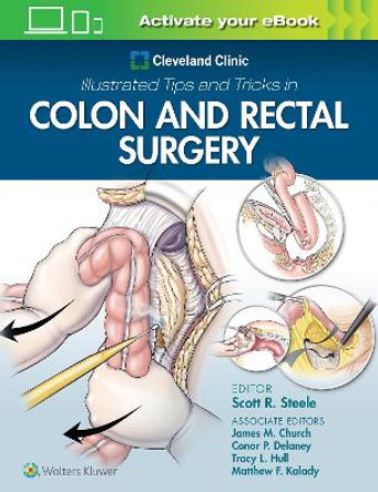 Cleveland Clinic Illustrated Tips and Tricks in Colon and Rectal Surgery by Steele 9781975108250