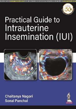 Practical Guide to Intrauterine Insemination (IUI) by Chaitanya Nagori 9789390595167