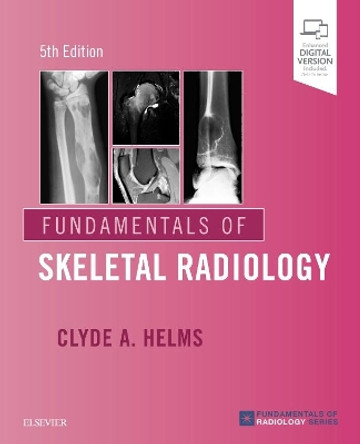 Fundamentals of Skeletal Radiology by Clyde A. Helms 9780323611657