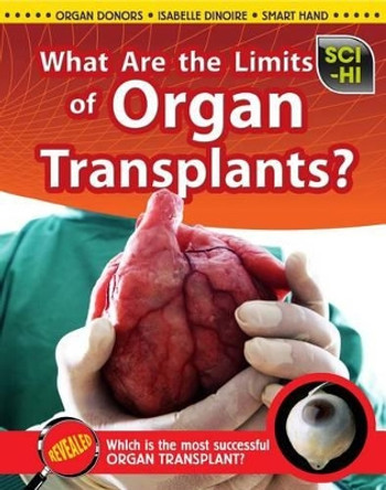 What Are the Limits of Organ Transplants? by Anna Claybourne 9781410944665