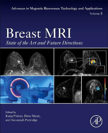Breast MRI: State of the Art and Future Directions: Volume 5 by Katja Pinker