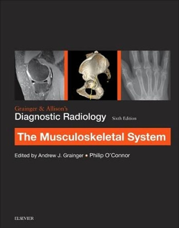 Grainger & Allison's Diagnostic Radiology: Musculoskeletal System by Andrew J. Grainger 9780702069369