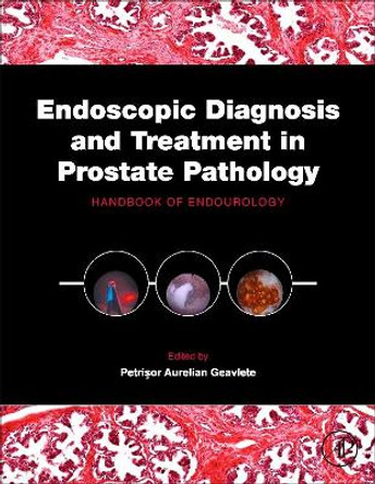 Endoscopic Diagnosis and Treatment in Prostate Pathology: Handbook of Endourology by Petrisor Aurelian Geavlete 9780128024058