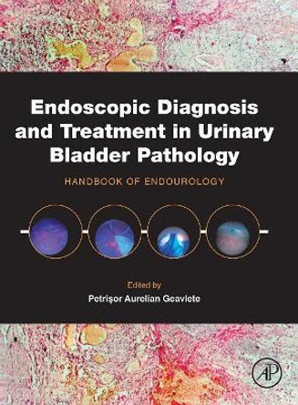 Endoscopic Diagnosis and Treatment in Urinary Bladder Pathology: Handbook of Endourology by Petrisor Aurelian Geavlete 9780128024393