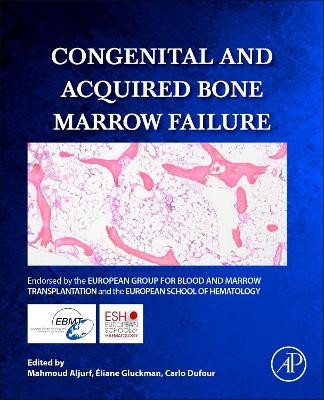 Congenital and Acquired Bone Marrow Failure by Mahmoud Deeb Aljurf 9780128041529