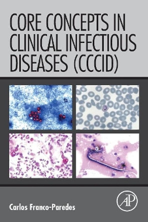 Core Concepts in Clinical Infectious Diseases (CCCID) by Carlos Franco-Paredes 9780128044230