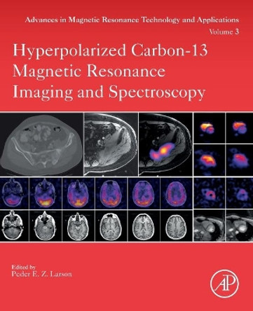 Hyperpolarized Carbon-13 Magnetic Resonance Imaging and Spectroscopy by Peder Larson 9780128222690