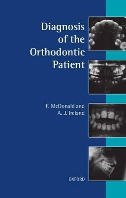 Diagnosis of the Orthodontic Patient by F. McDonald 9780192628893
