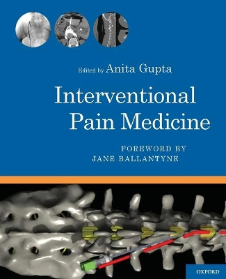 Interventional Pain Medicine by Anita Gupta 9780199740604