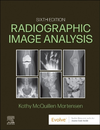 Radiographic Image Analysis by Kathy McQuillen-Martensen 9780323930697