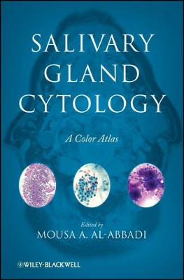 Salivary Gland Cytology: A Color Atlas by Mousa A. Al-Abbadi 9780470500927