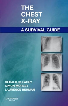 The Chest X-Ray: A Survival Guide by Gerald De Lacey 9780702030468