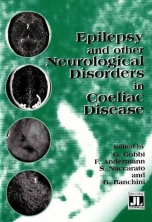 Epilepsy and Other Neurological Disorders in Coeliac Disease by Giuseppe Gobbi 9780861965373