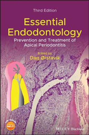Essential Endodontology: Prevention and Treatment of Apical Periodontitis by Dag Orstavik 9781119271956