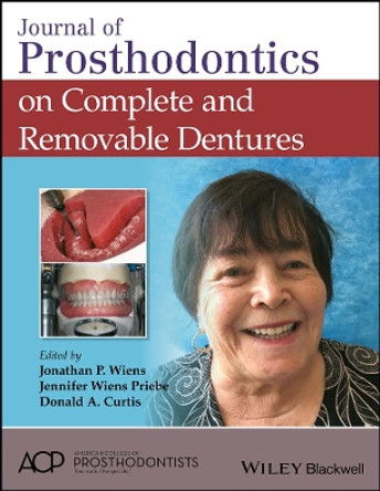 Journal of Prosthodontics on Complete and Removable Dentures by Jonathan P. Wiens 9781119442622