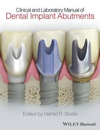 Clinical and Laboratory Manual of Dental Implant Abutments by Hamid Shafie 9781119949817