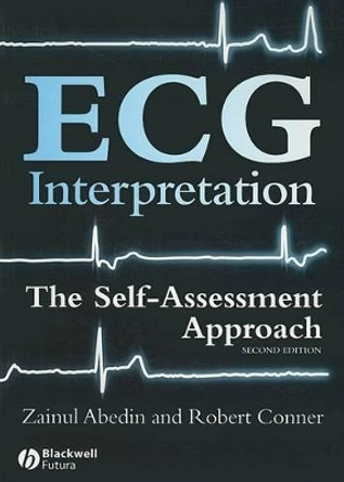 ECG Interpretation: The Self-Assessment Approach by Zainul Abedin 9781405167499