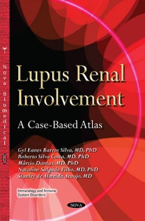 Lupus Renal Involvement: A Case-Based Atlas by Roberto Silva Costa 9781634638340