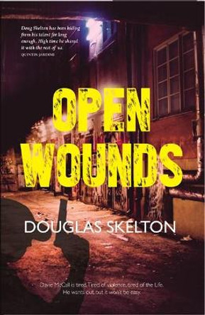 Open Wounds by Douglas Skelton 9781910745335