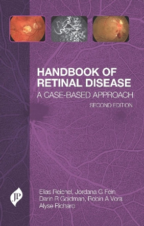 Handbook of Retinal Disease: A Case-Based Approach by Elias Reichel 9781787791701
