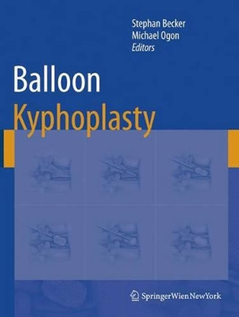 Balloon Kyphoplasty by Stephan Becker 9783211999080