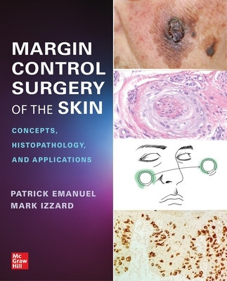 Margin Control Surgery of the Skin: Concepts, Histopathology, and Applications by Patrick Emanuel 9781264285990