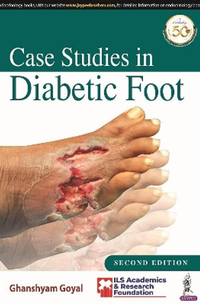 Case Studies in Diabetic Foot by Ghanshyam Goyal 9789390595471