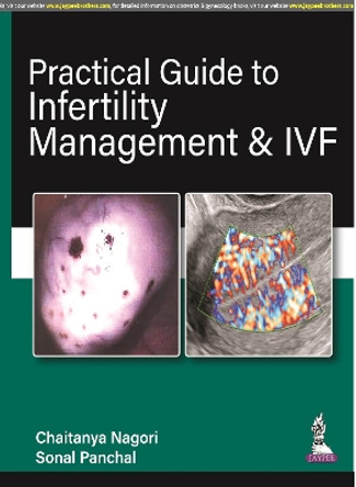 Practical Guide to Infertility Management & IVF by Chaitanya Nagori 9789390595914