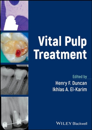Vital Pulp Treatment by Henry F. Duncan 9781119930389