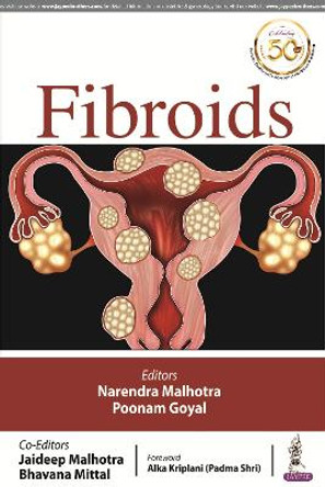 FIBROIDS by Narendra Malhotra 9789352705498