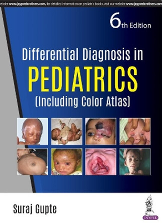 Differential Diagnosis in Pediatrics: (Including Color Atlas) by Suraj Gupte 9789352702473