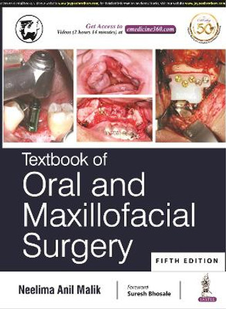 Textbook of Oral and Maxillofacial Surgery by Neelima Anil Malik 9789352705788