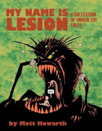 My Name Is Lesion: A Collection of Unhealthy Tales by Matt Howarth 9780615659527