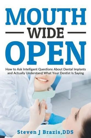 Mouth Wide Open: How To Ask Intelligent Questions About Dental Implants and Actually Understand What Your Dentist Is Saying by Steven J Brazis Dds 9780692728406