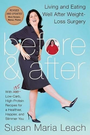 Before and After: Living and Eating Well After Weight-loss Surgery by Susan Maria Leach 9780061242854