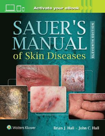 Sauer's Manual of Skin Diseases by Brian J. Hall