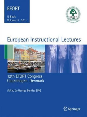 European Instructional Lectures: Volume 11, 2011, 12th EFORT Congress, Copenhagen, Denmark by George Bentley 9783642183201