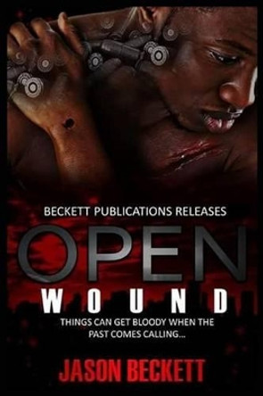 Open Wound 1 by Jayne Phlow 9780692511091