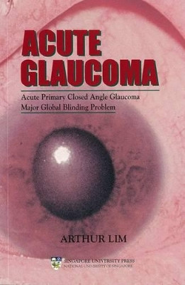 Acute Glaucoma: Acute Primary Closed Angle Glaucoma - a Major Global Blinding Problem by Arthur Lim 9789810459482