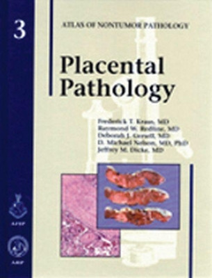 Placental Pathology by F. T. Kraus 9781881041894
