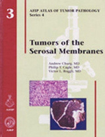 Tumors of the Serosal Membranes by Andrew Churg 9781881041979