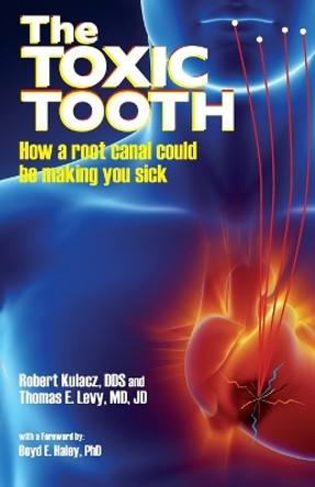 The Toxic Tooth: How a root canal could be making you sick by Dds Robert Kulacz 9780983772828