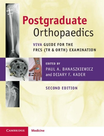 Postgraduate Orthopaedics: Viva Guide for the FRCS (Tr & Orth) Examination by Paul A. Banaszkiewicz 9781108722155