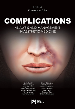 Complications: Analysis and Management in Aesthetic Medicine by Giuseppe Sito 9788897438762