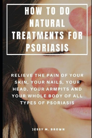 How to Do Natural Treatments for Psoriasis: Relieve the Pain of Your Skin, Your Nails, Your Head, Your Armpits and Your Whole Body of All Types of Psoriasis by Jessy M Brown 9781095206454